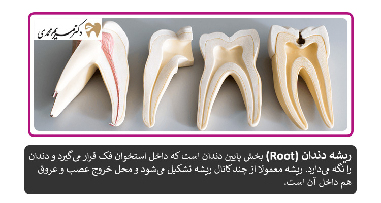 ریشه دندان