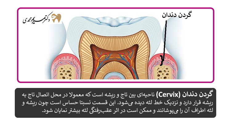 گردن دندان