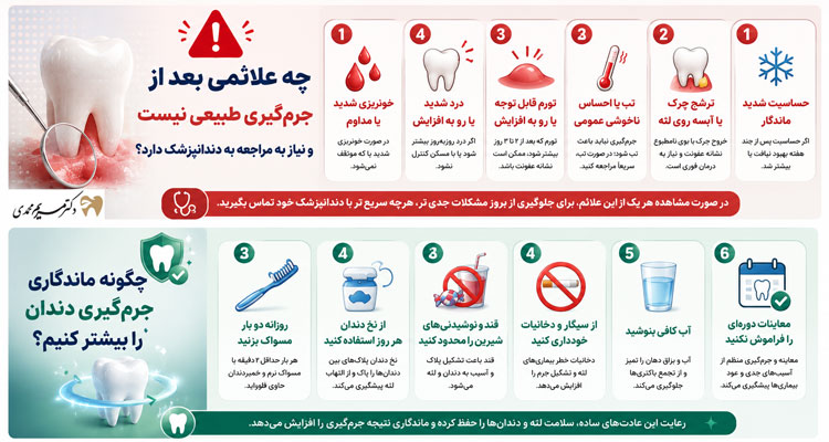 افزایش ماندگاری جرم گیری دندان و علائم غیرطبیعی آن
