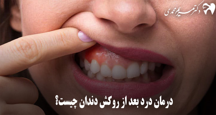 درمان خانگی درد دندان روکش شده
