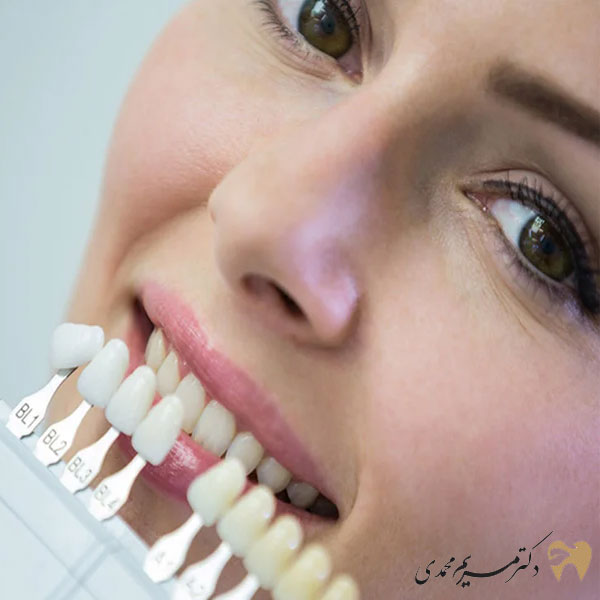 انجام کامپوزیت دندان در کرج