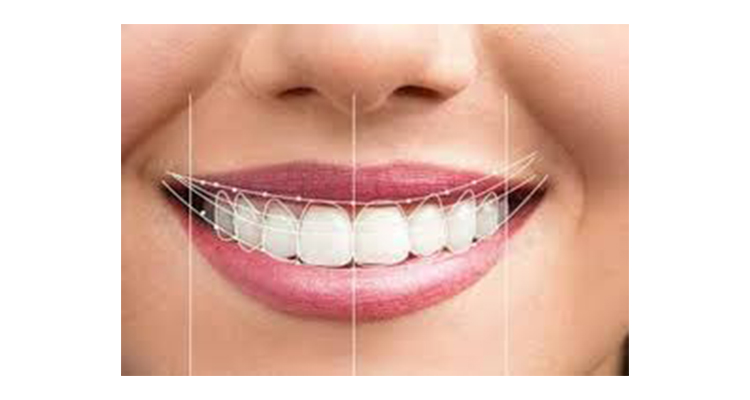 اصلاح لبخند لثه ای 
