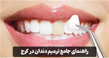 راهنمای جامع ترمیم دندان در کرج